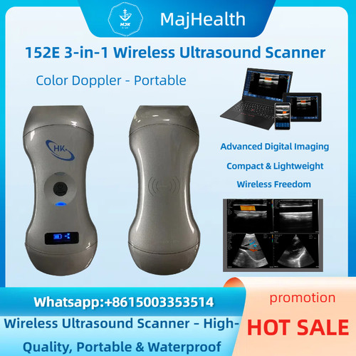 152e scanner ultrasuoni - 152e,