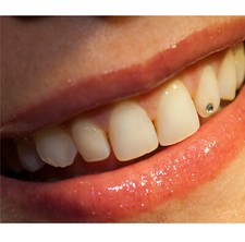 Pietre per gioielli da denti