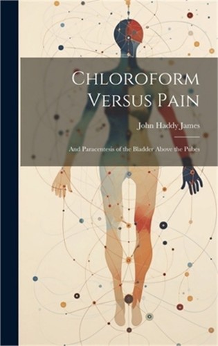 Chloroform versus pain - versus, pain: