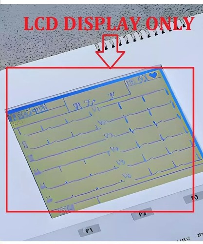 Display lcd per nihon kohden - display,