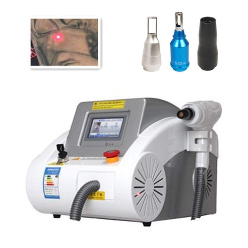Yueyi yag laser rimozione - yag,