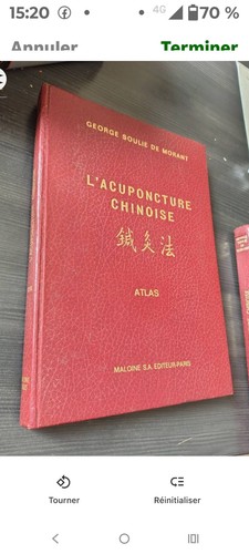 Accuponncture chinoise - l'accuponncture,