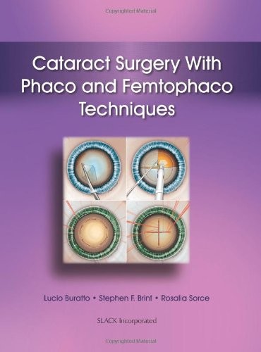 Cataract surgery with phaco - surgery,