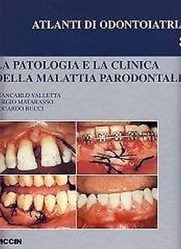 Giancarlo valletta la - giancarlo,