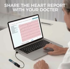 Holter Monitor 24 ore Monitor