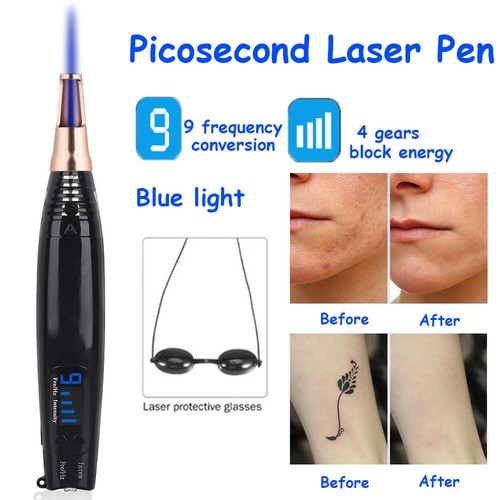 Penna laser pico rimozione - laser,