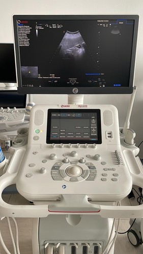 Esaote mylabx8 - esaote,