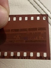 NEGATIVO FOTOTIFO ULTRAS