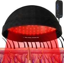 Sistema Di Terapia Laser per