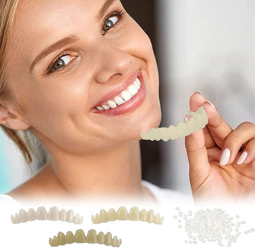 Faccette denti cosmetici - faccette, cosmetici,denti