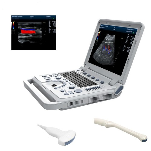Scanner ultrasuoni portatile - scanner,