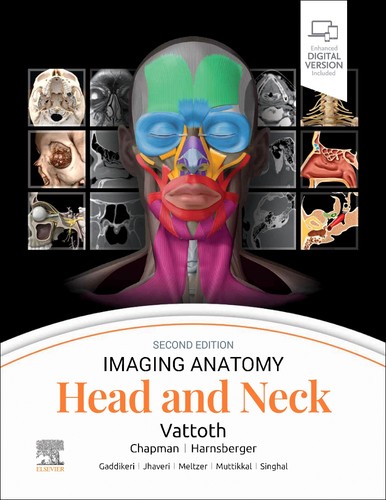Imaging anatomy head and - imaging, neck