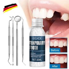 Set protesi provvisorie