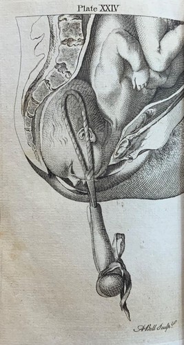 1784 midwifery - 1784, (hamilton)