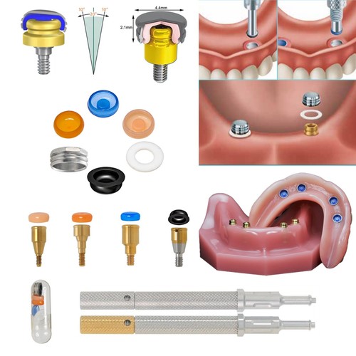 Kit inserti ritenzione tappo