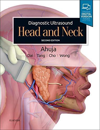 Diagnostic ultrasound head - diagnostic,