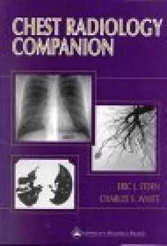 Chest radiology companion - chest,