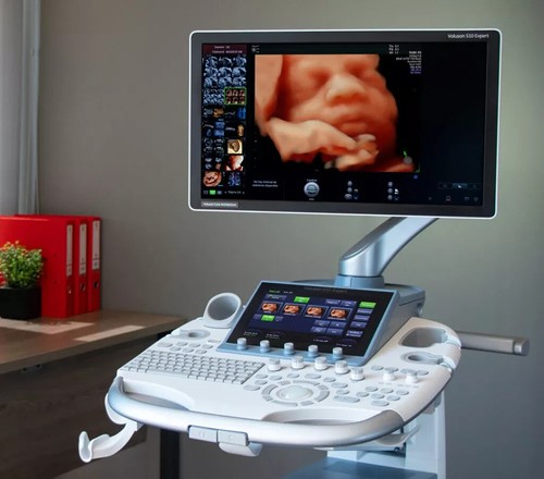 Ultrasound software - ultrasound,