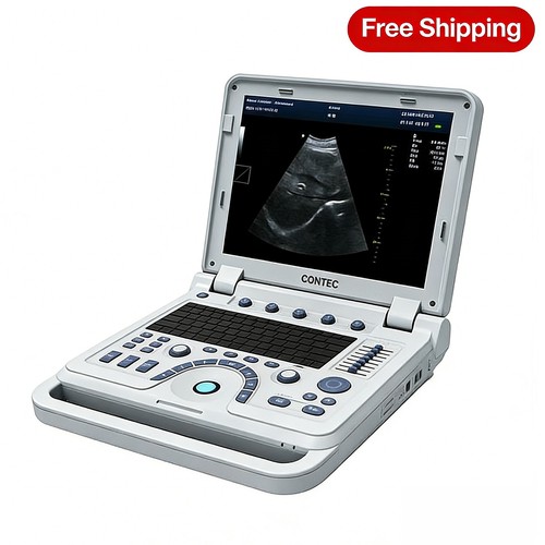 Scanner ultrasuoni portatile - scanner,