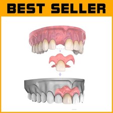 Protesi dentali rimovibili di