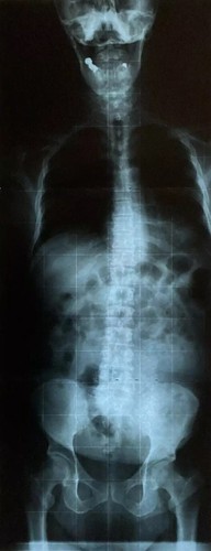 Vintage ray film - x-ray,