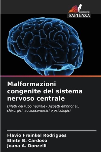 Malformazioni congenite del