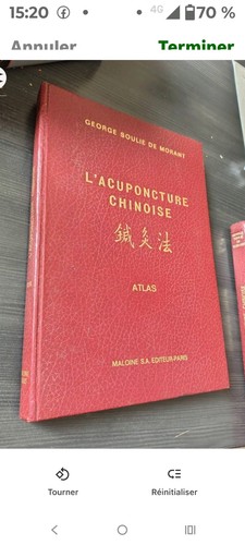 Accuponncture chinoise - chinoise,