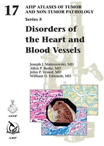 Disorders the heart - of,