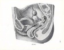 Stampa antica ANATOMIA