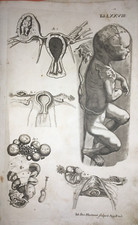 MEDICINA-PEDIATRIA-OSTETRICIA-GINECOLOGIA-FETO-ANTICA INCISIONE-HARTMAN-'700