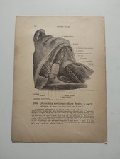 Lotto 2 Stampe Anatomiche Mediche Ghiandola Salivari HE Werner Spalteholz Vintag