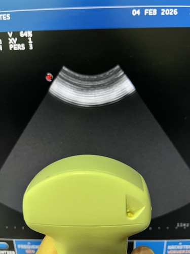 Esaote probe ca431 sonda - ca431,
