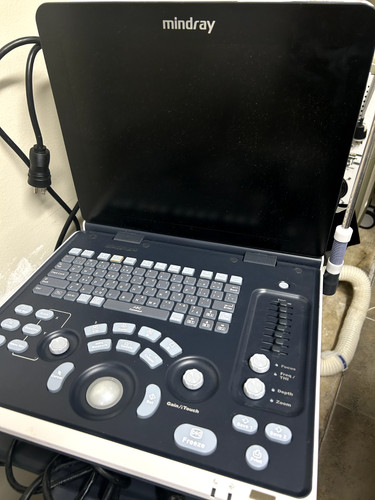 Mindray digital ultrasonic - digital,