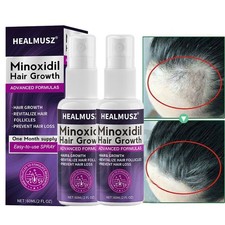 Minoxidil 2% Extra Forza