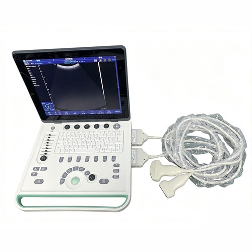 Ultrasuoni doppler colori - ultrasuoni, a