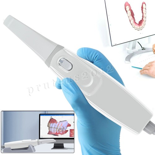 Scanner digitale dentale
