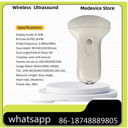 New wireless ultrasound convex - ultrasound,