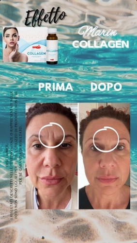 Promo snep marine collagen - snep,