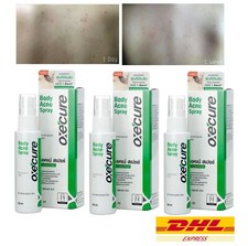 3 Oxe Cure Spray Corpo Riduce
