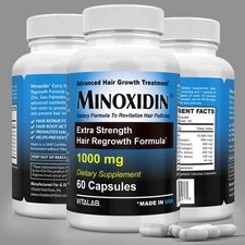 2X Minoxidina Ufficiale 1000mg