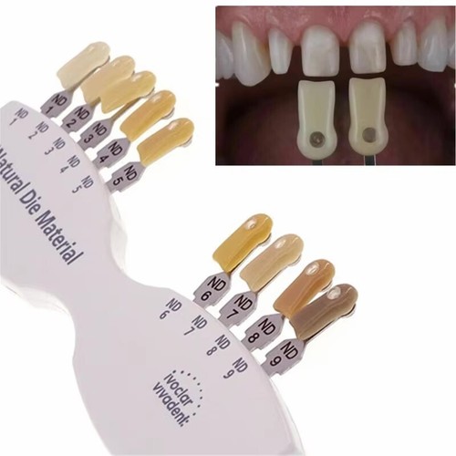 Dental ips ivoclar - ips, vivadent