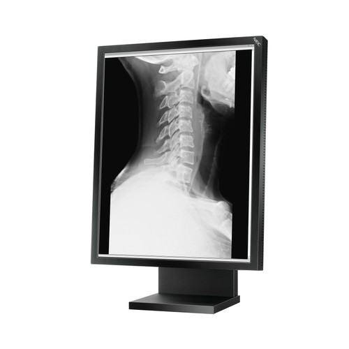 Nec md21gs 2mp - md21gs-2mp, monitor