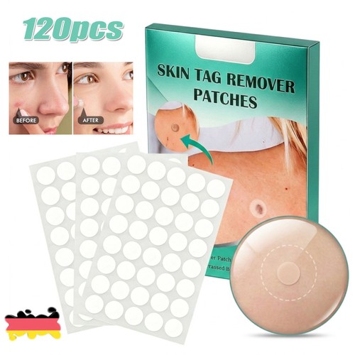 120pz skin tag remover patch - 120pz,