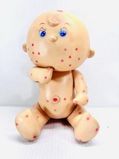 Tondo Morbillo Bambola