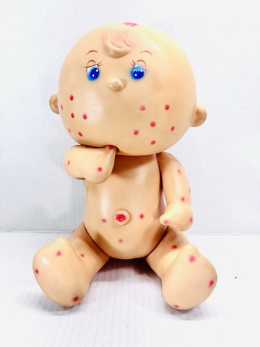 Tondo morbillo bambola - morbillo,