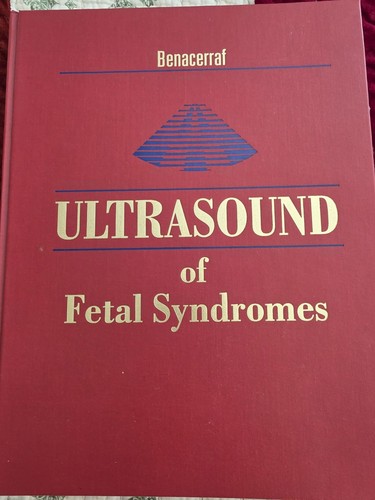Ultrasound fetal syndromes - ultrasound,