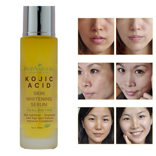 Kojic acid sbiancante - kojic,