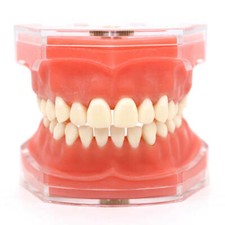 Modello dentatura ortodontica