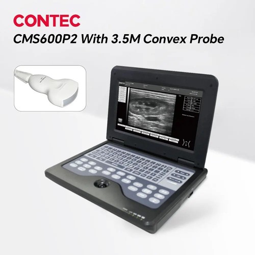 Cms600p2 scanner ecografico - cms600p2,