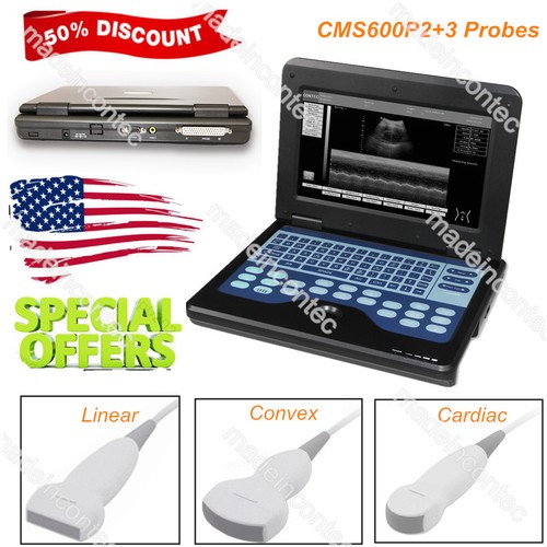 Scanner ultrasuoni portatile - scanner,